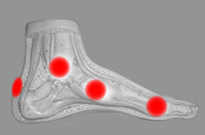Bootfit points